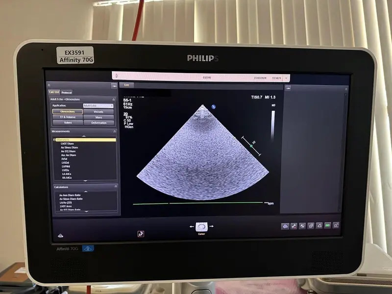 2015 Philips Affiniti 70G, photo 3