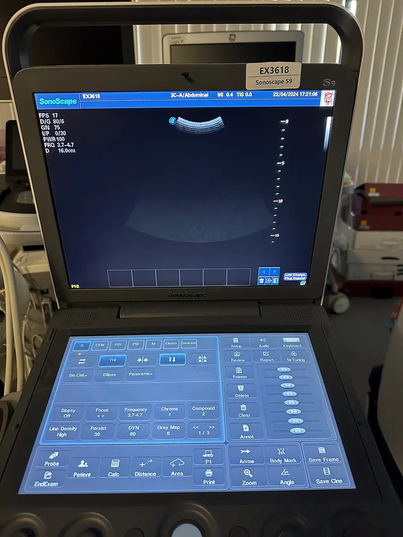 2019 SonoScape S9, photo 4