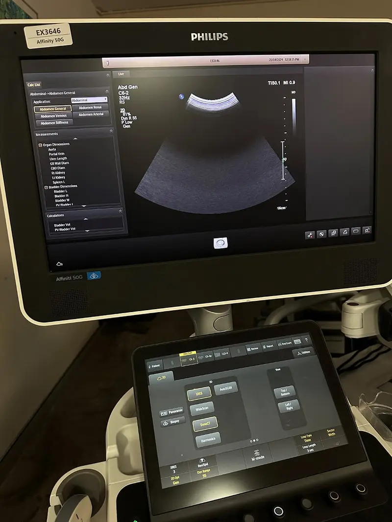 2016 Philips Affiniti 50G, photo 4