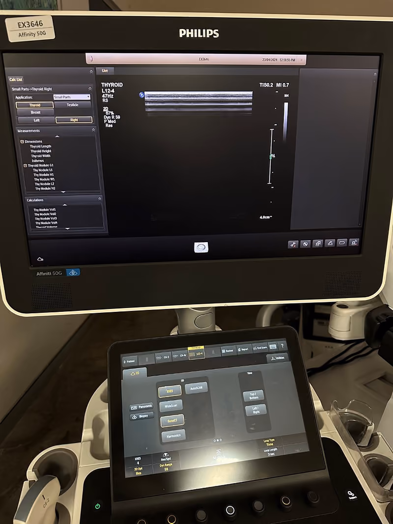 2016 Philips Affiniti 50G, photo 5