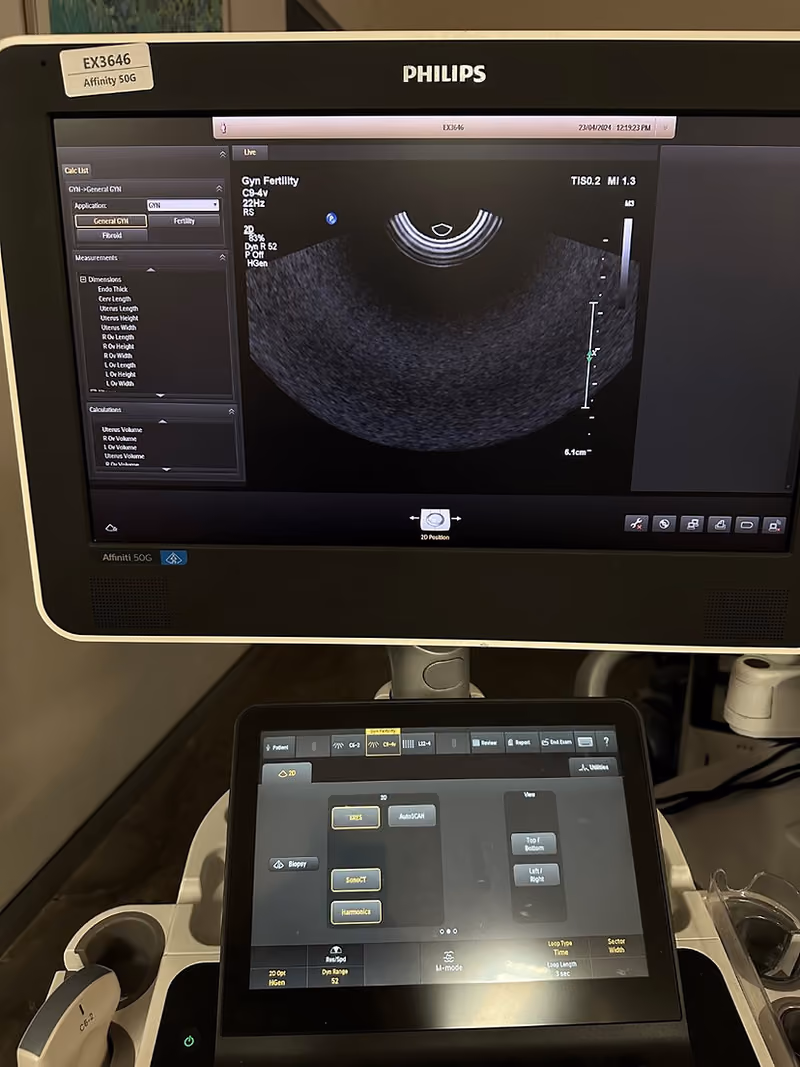 2016 Philips Affiniti 50G, photo 6