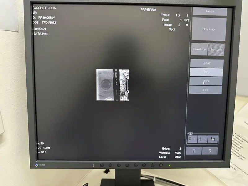 2008 Shimadzu Sonialvision Versa Screening Room, photo 3