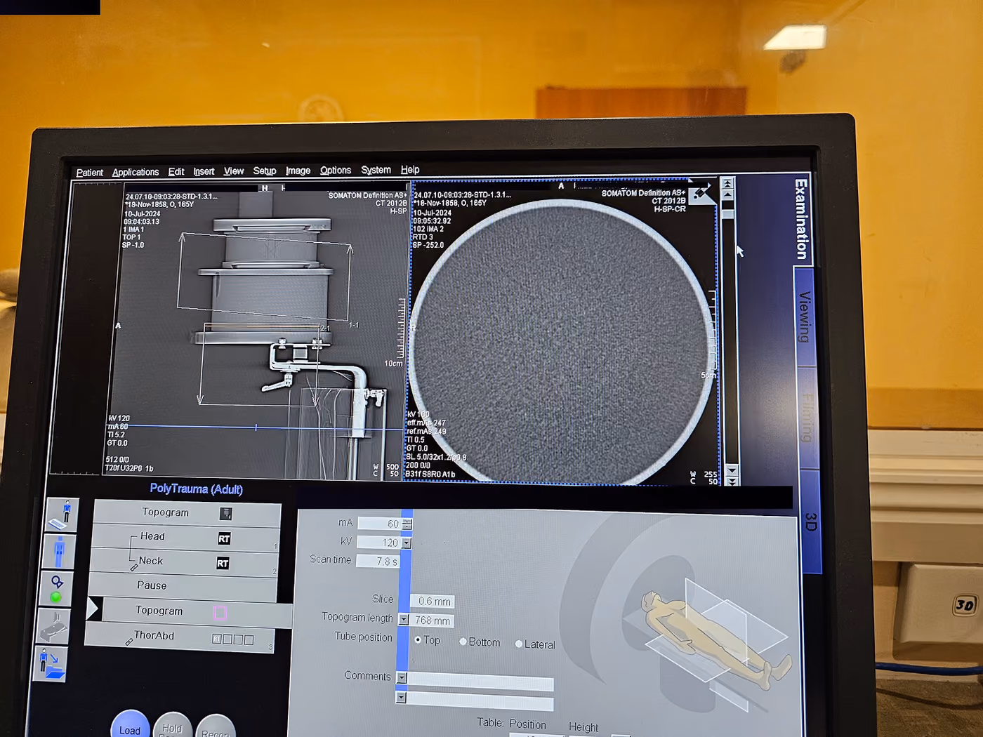 2014 Siemens Somatom Definition AS+ 128 Slice with 2024 Tube, photo 12