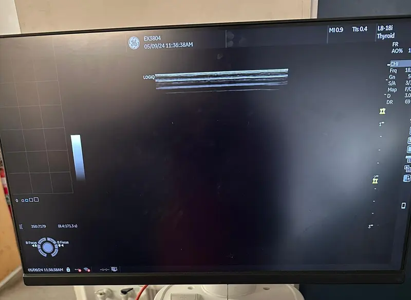 2022 GE Logiq P9, photo 3