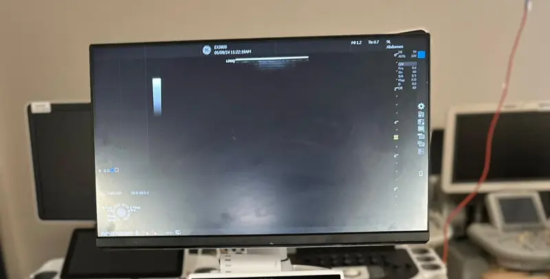 2022 GE Logiq P9, photo 3