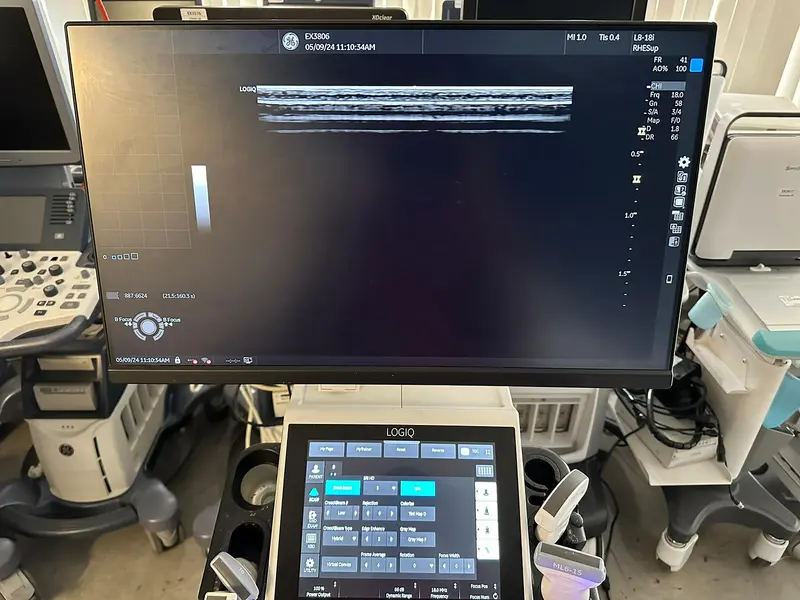 2022 GE Logiq P9, photo 3