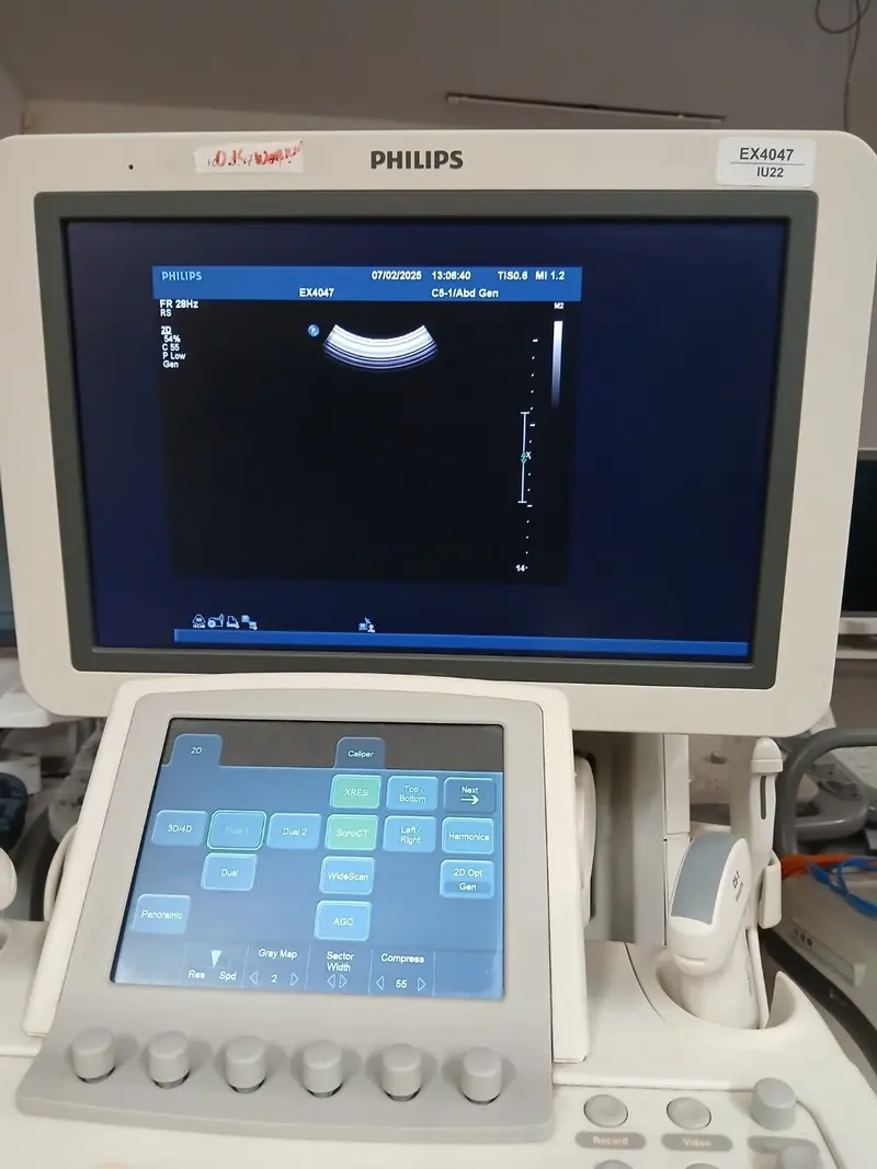 2012 Philips iU22 Cart G.1, photo 3