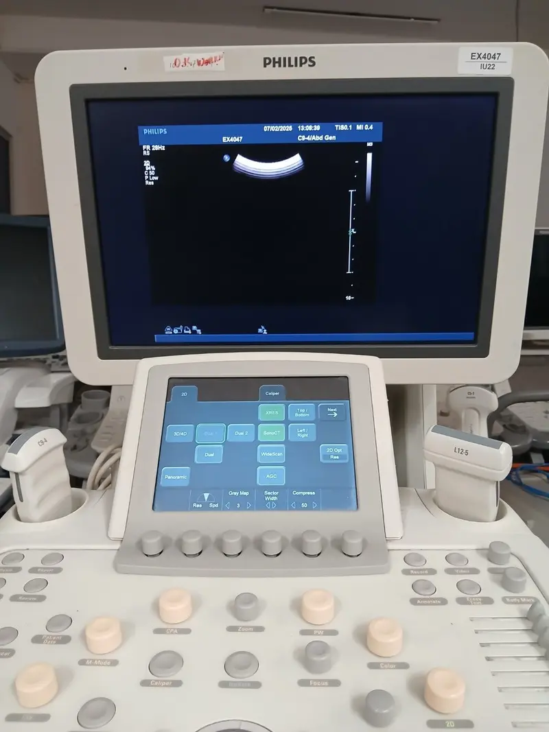 2012 Philips iU22 Cart G.1, photo 4
