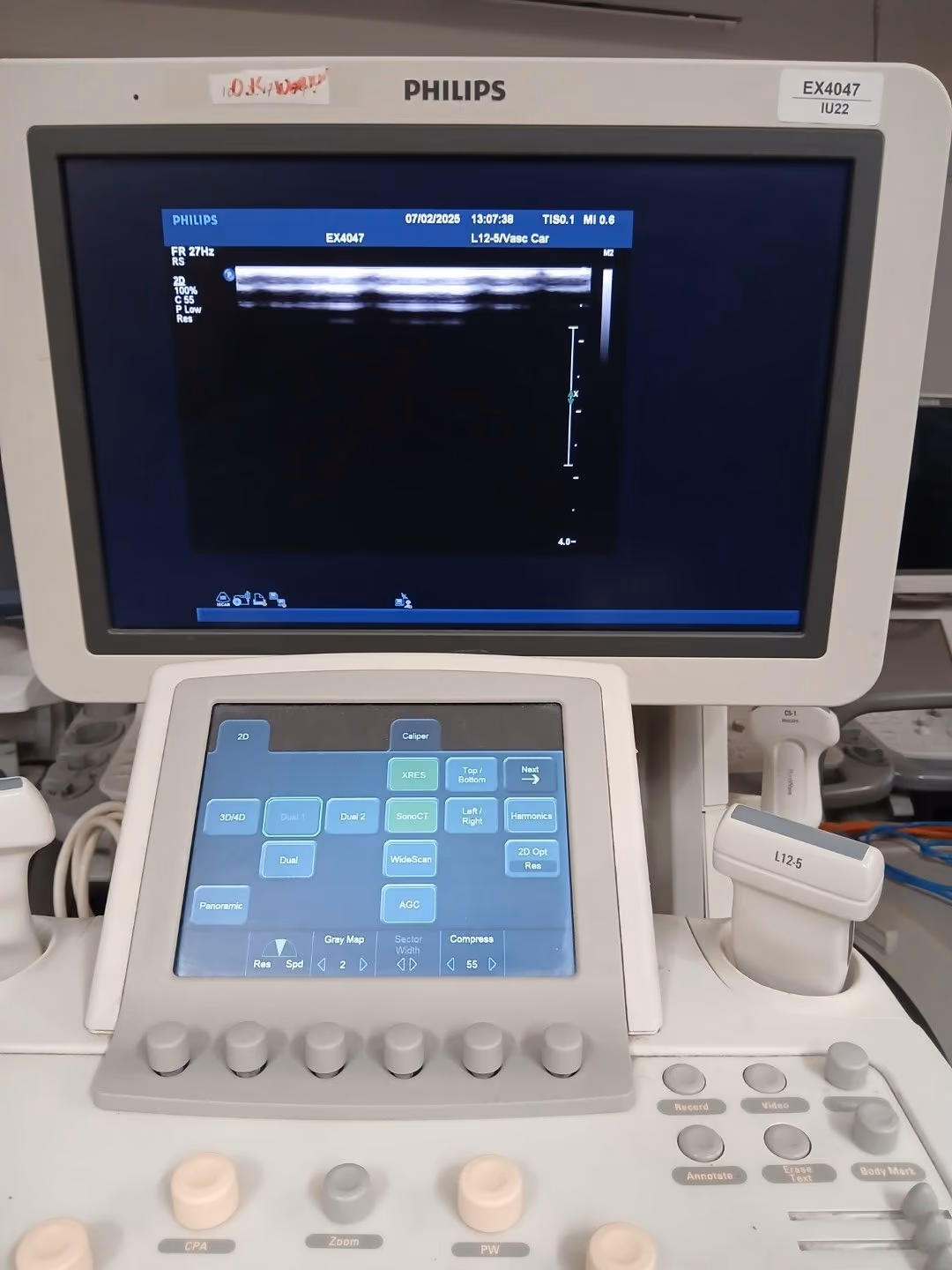 2012 Philips iU22 Cart G.1, photo 5