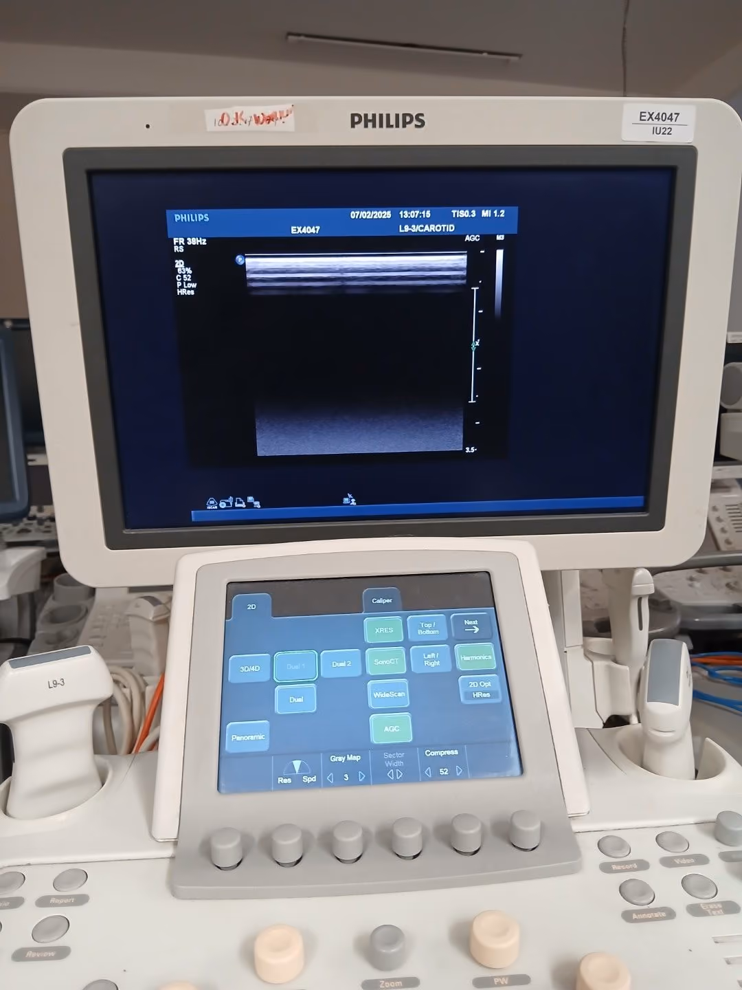 2012 Philips iU22 Cart G.1, photo 6