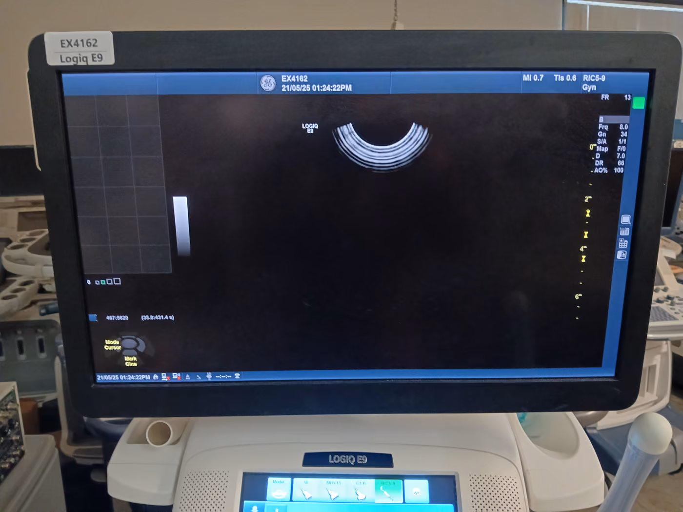 2016 GE Logiq E9, photo 5