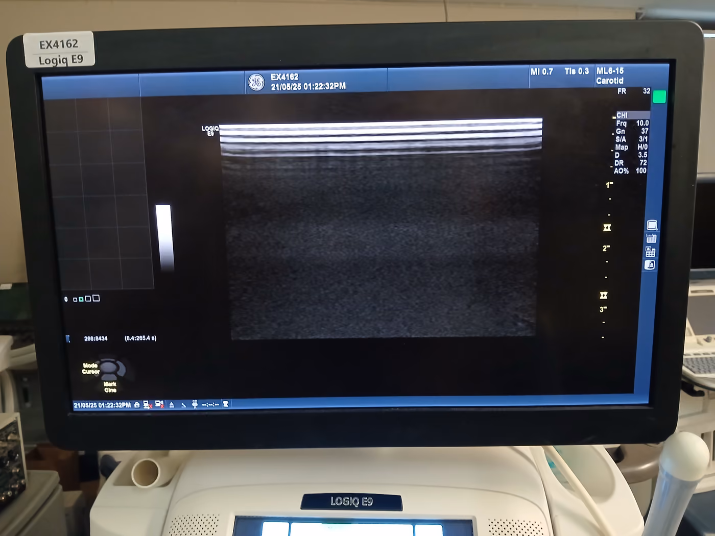 2016 GE Logiq E9, photo 6