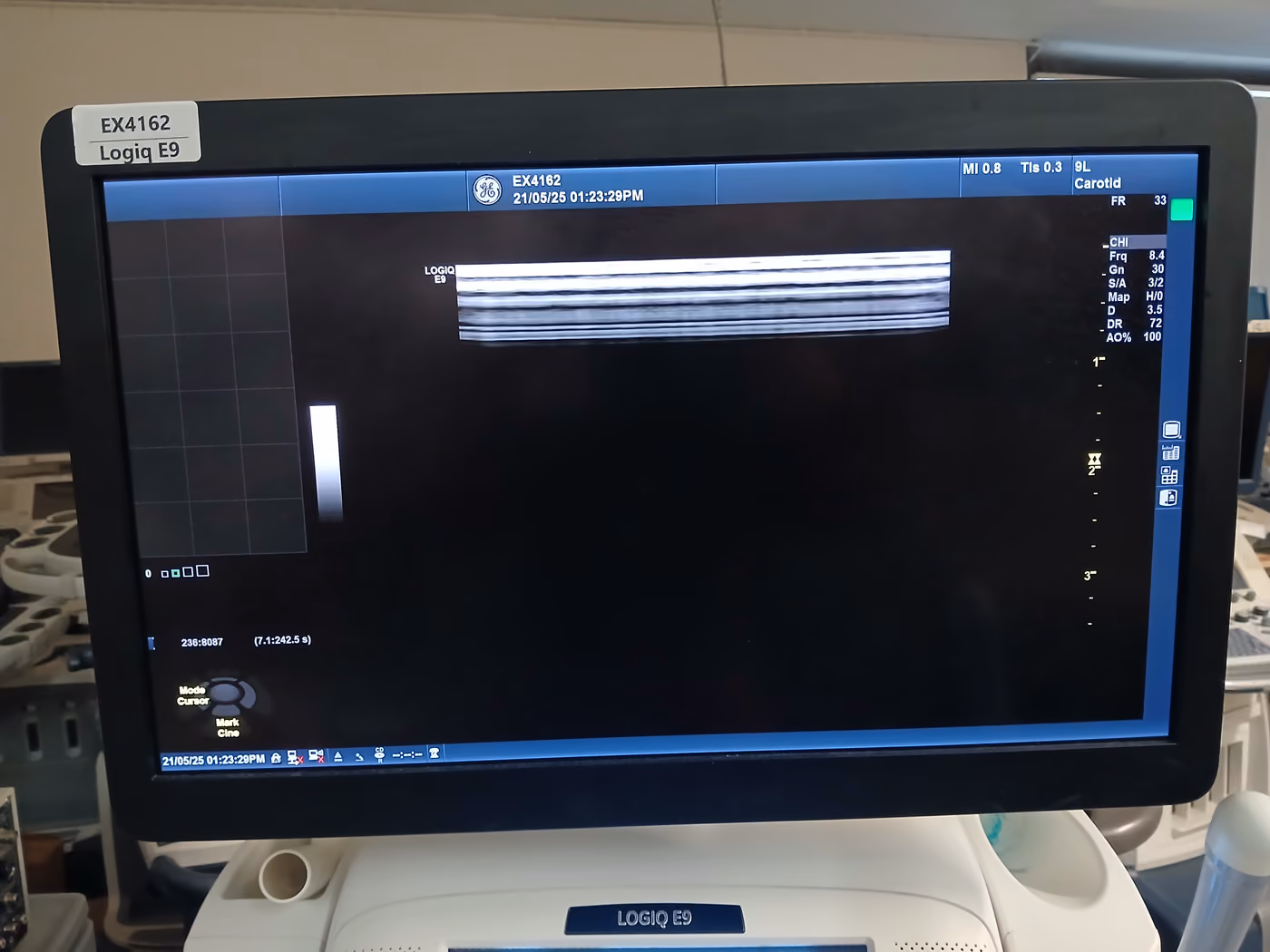 2016 GE Logiq E9, photo 7