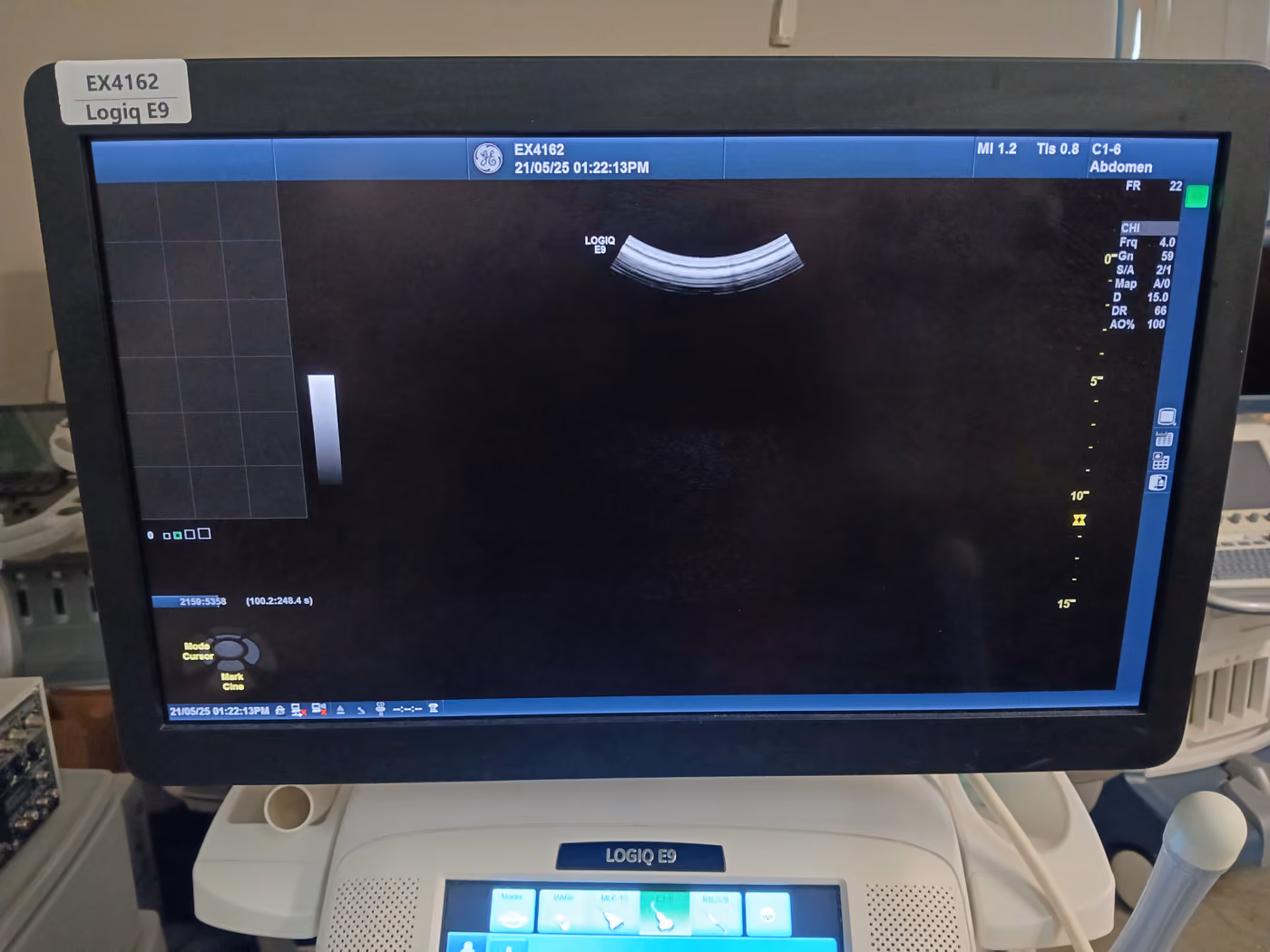 2016 GE Logiq E9, photo 8