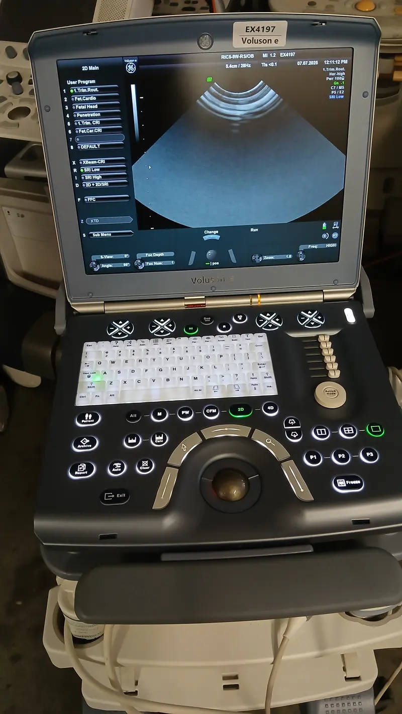 2014 GE Voluson e BT14, photo 3