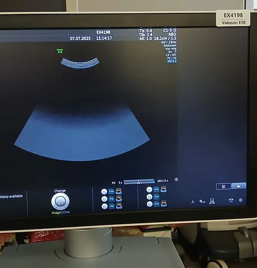 2015 GE Voluson E10 BT15, photo 4