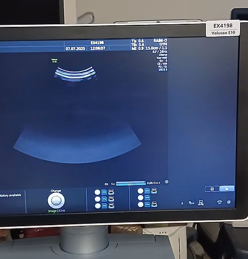 2015 GE Voluson E10 BT15, photo 6