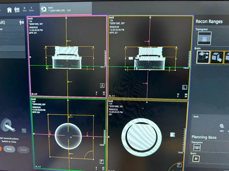 2022 Siemens Somatom go.Up, photo 2