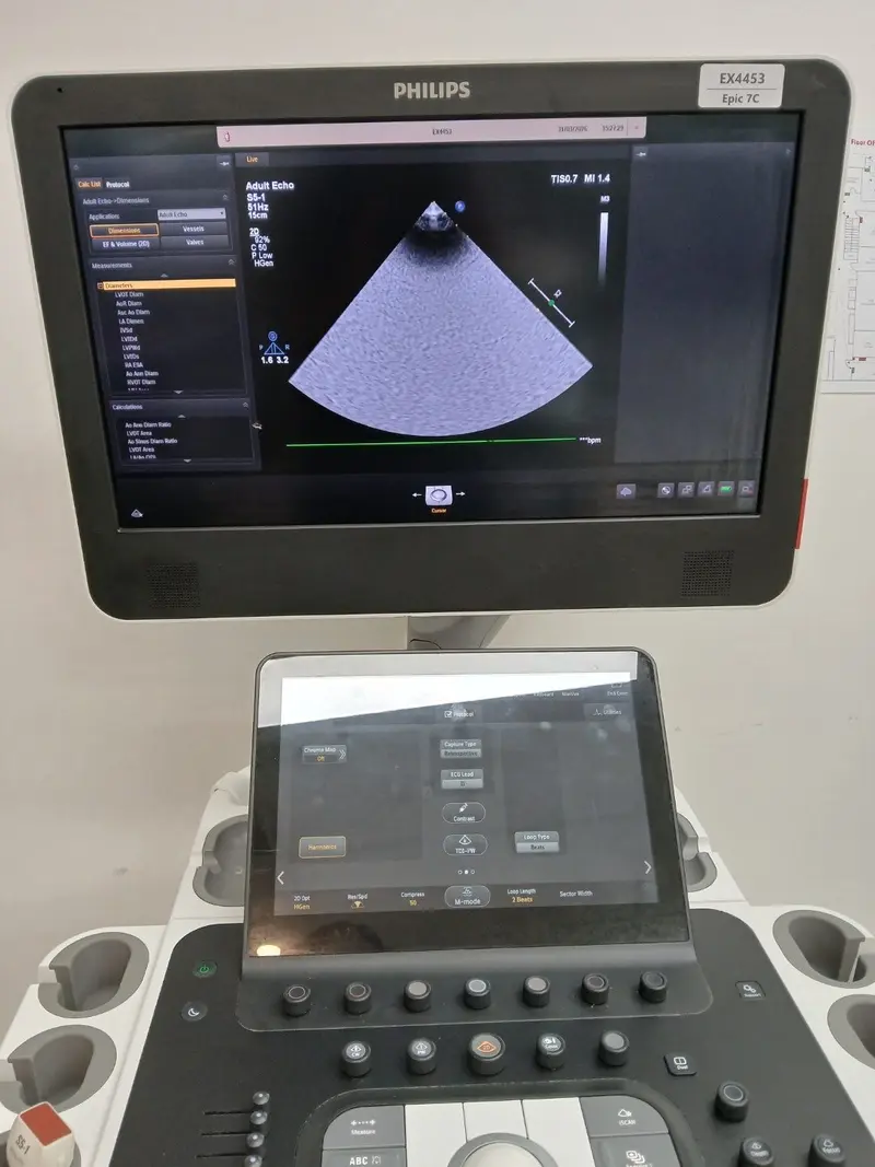 2019 Philips Epiq CV, photo 2