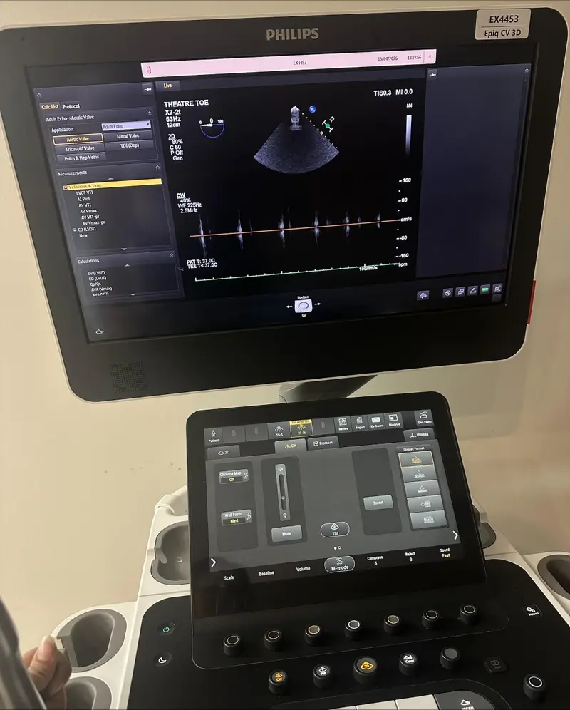 Philips X7-2t TEE Transducer, photo 4