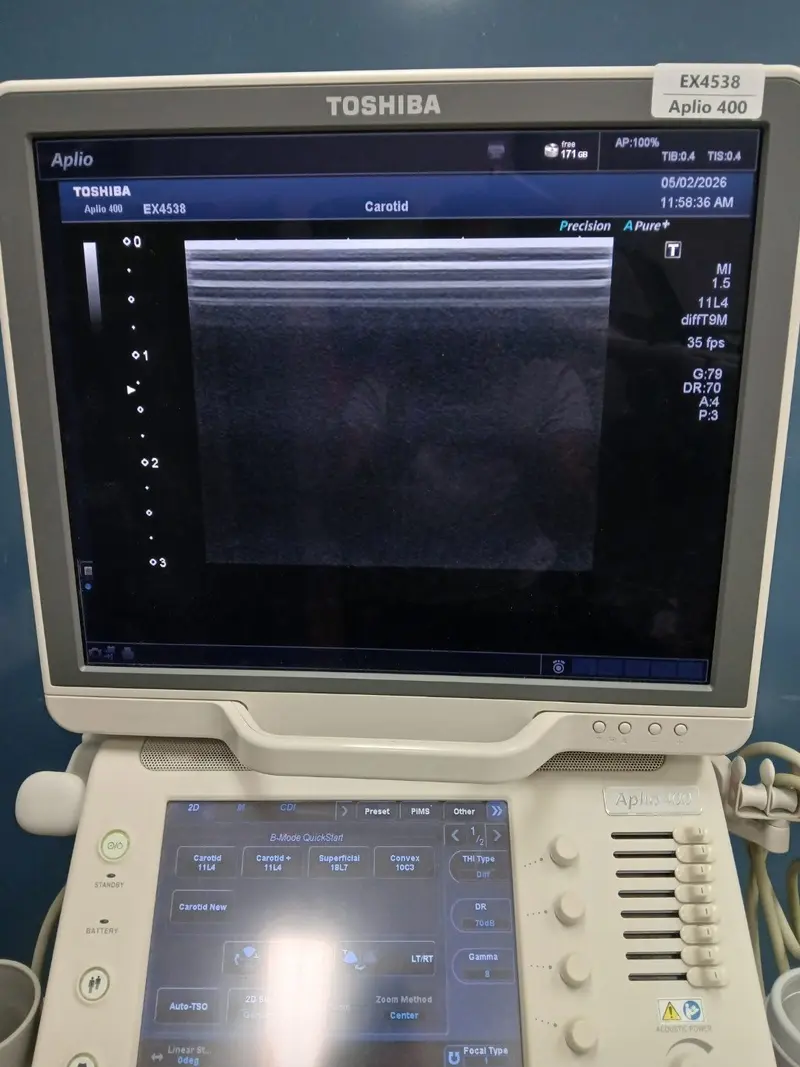 2012 Toshiba Aplio 400, photo 4