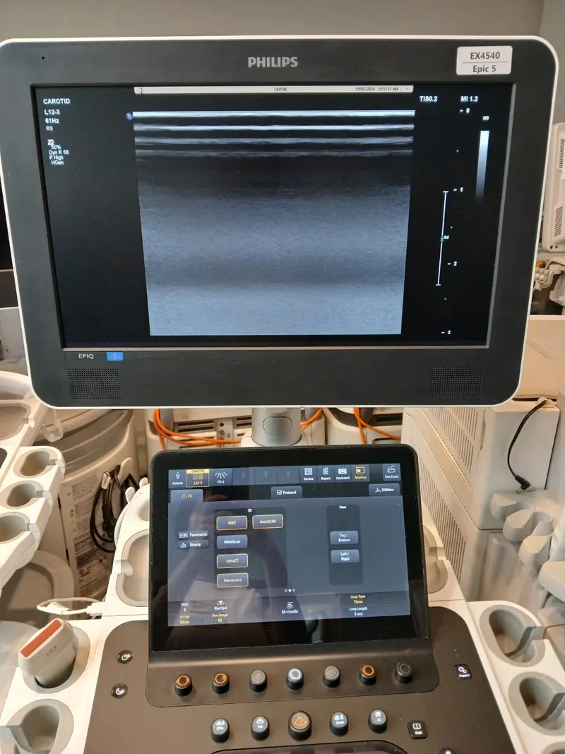 2017 Philips Epiq 5, photo 4