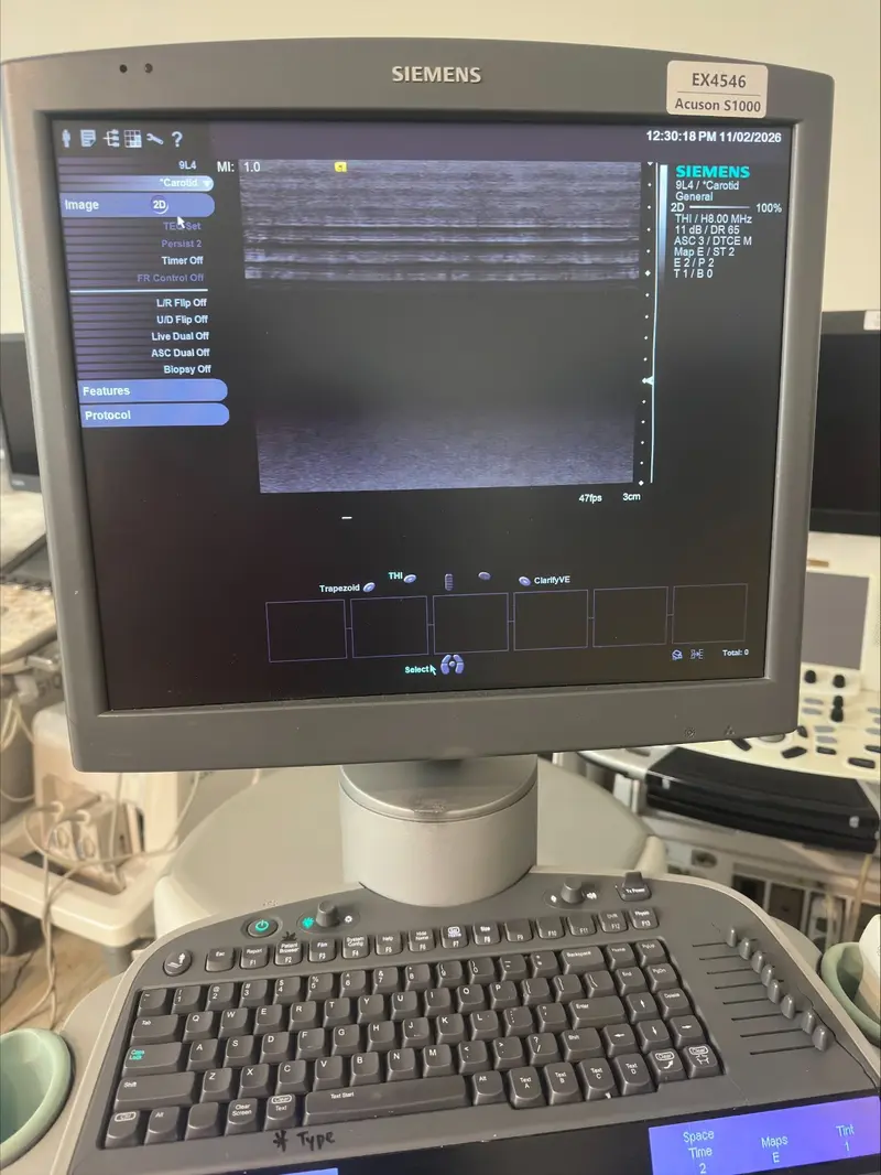 2011 Siemens Acuson S1000, photo 3