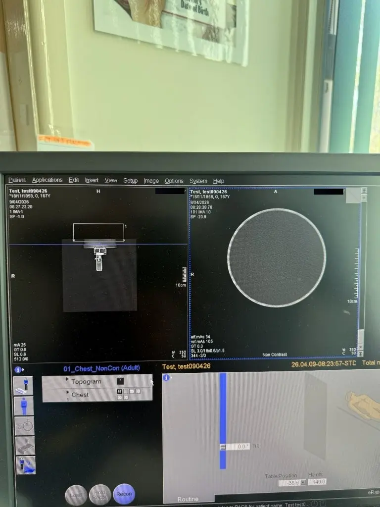 2016 Siemens Somatom Scope Power 16 Slice, photo 2