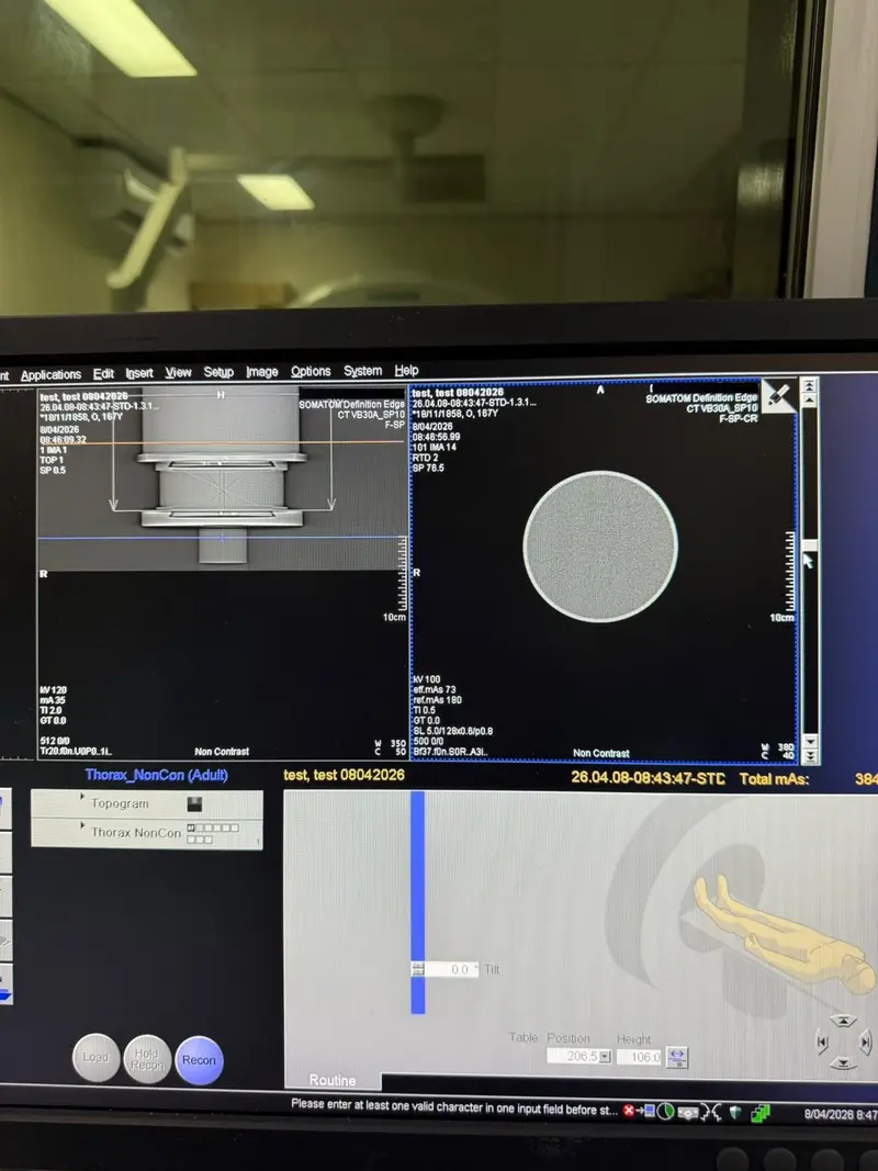 2015 Siemens Definition Edge 128 Slice, photo 2