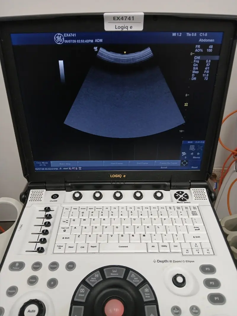 2020 GE Logiq e, photo 3