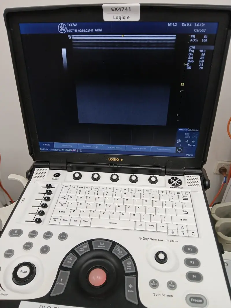 2020 GE Logiq e, photo 4