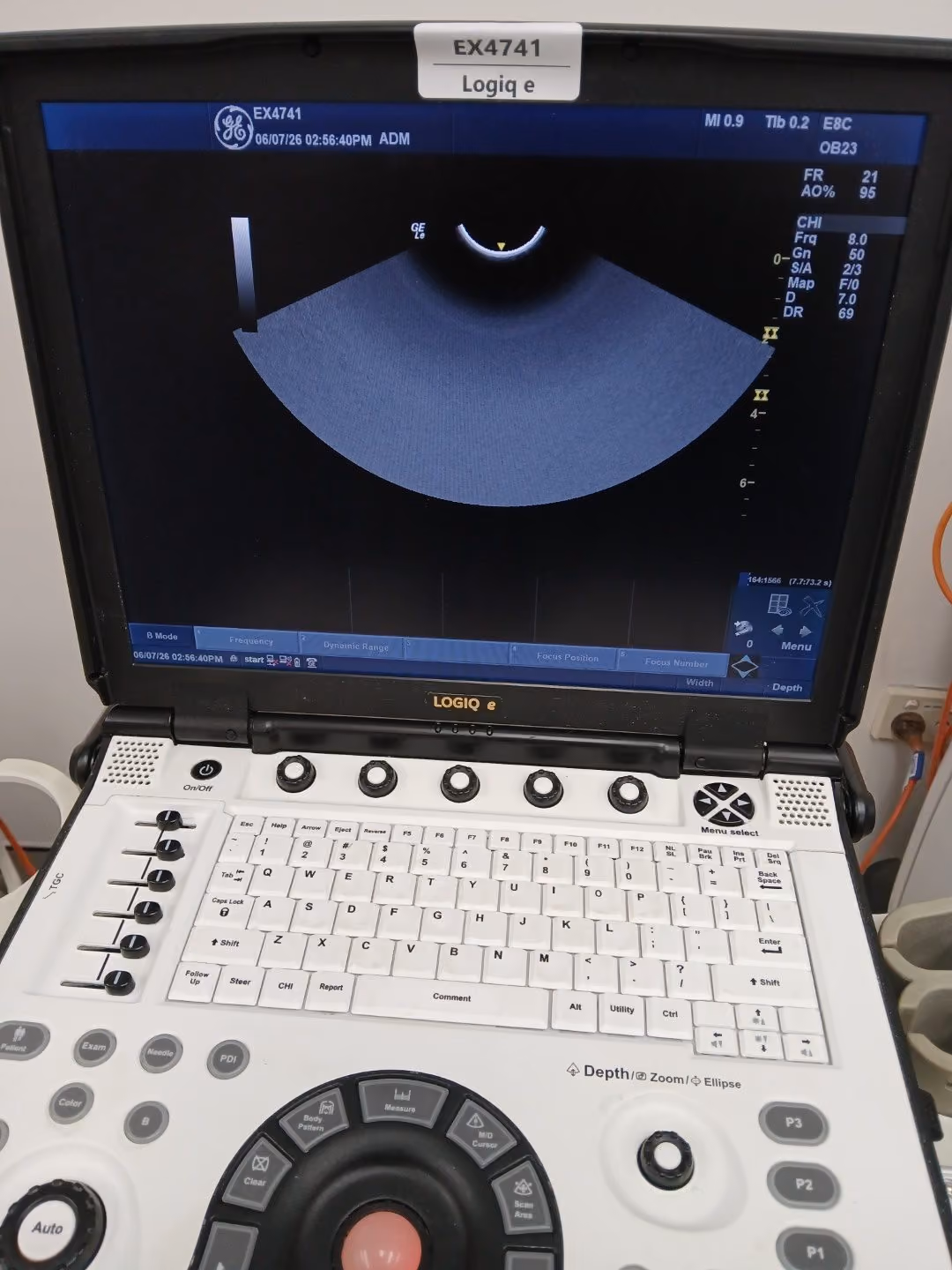 2020 GE Logiq e, photo 5