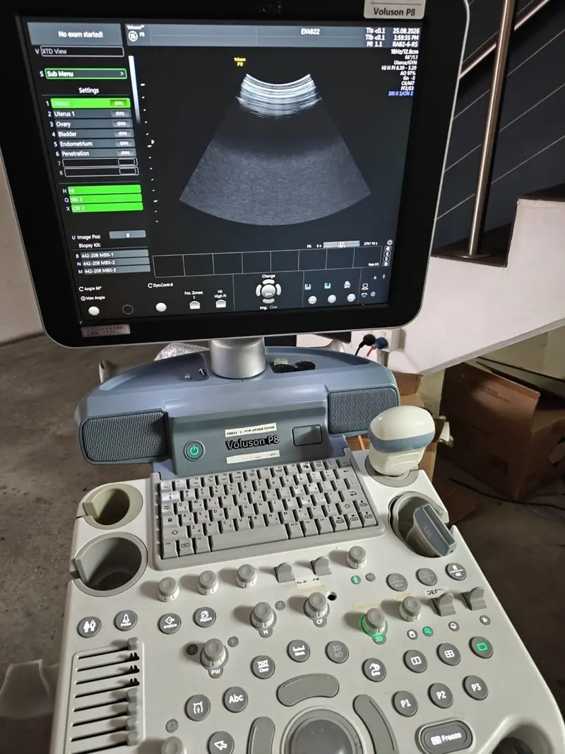 2022 GE Voluson P8, photo 3
