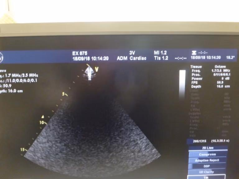 2008 GE Vivid 7 Dimension, photo 7