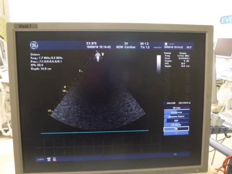 2008 GE Vivid 7 Dimension, photo 8