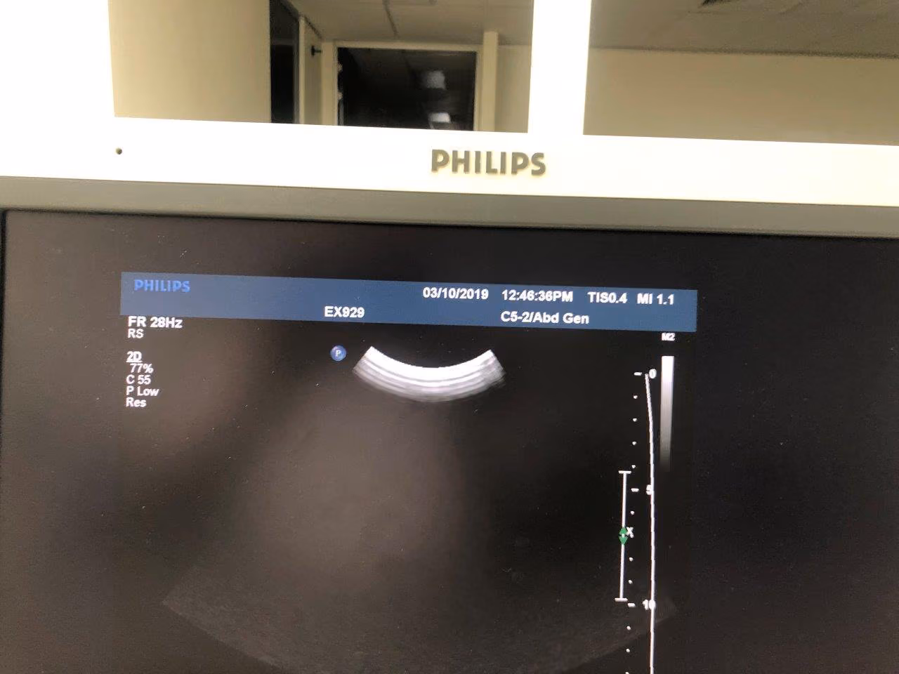 2009 Philips IU 22 Cart F.2, photo 5