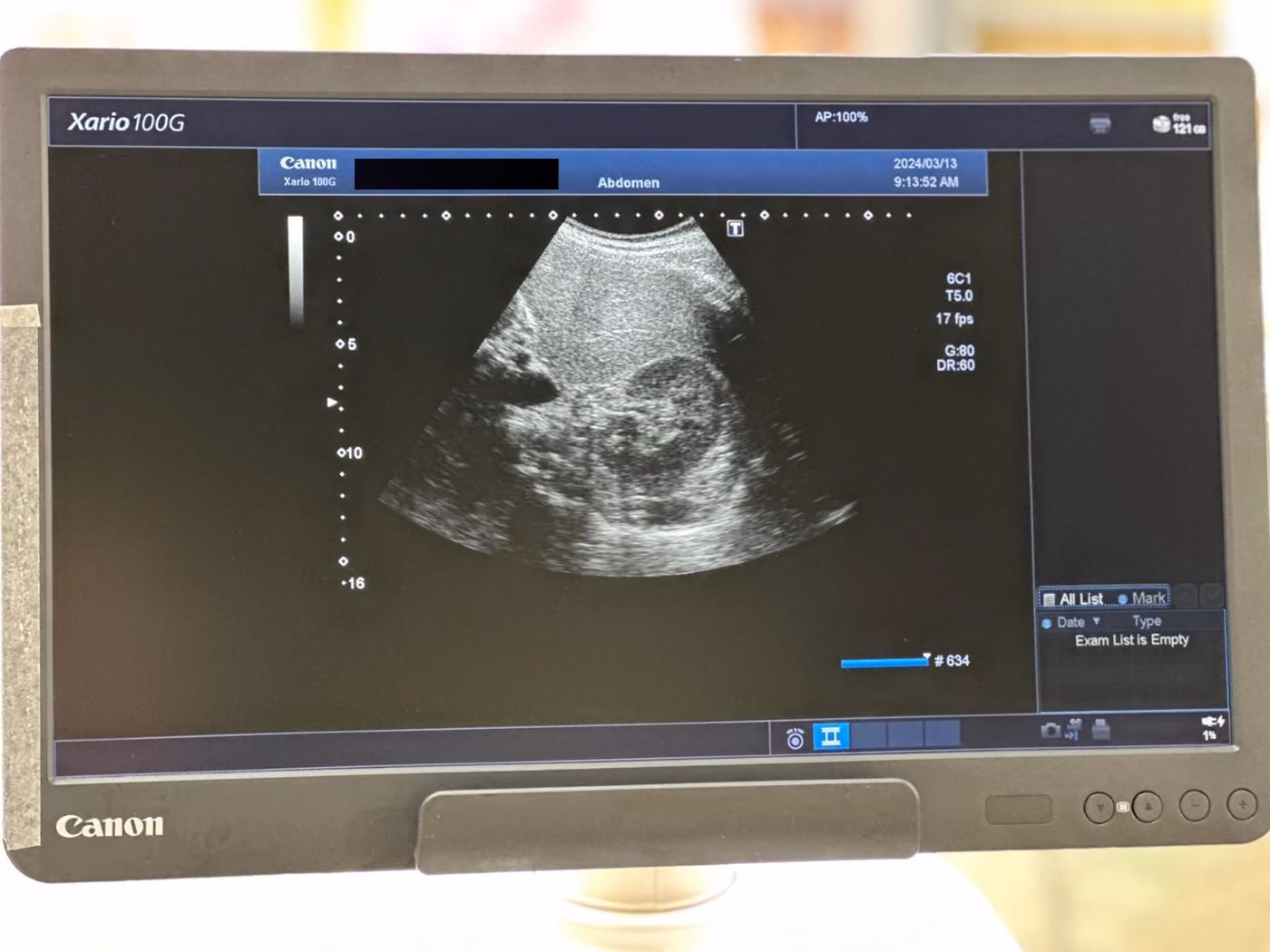 2022 Canon Xario 100G, photo 8