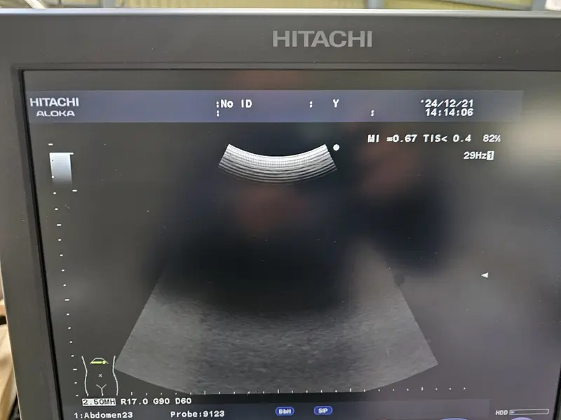 2011 Hitachi Aloka F37, photo 2
