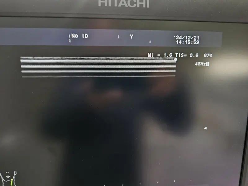 2011 Hitachi Aloka F37, photo 3
