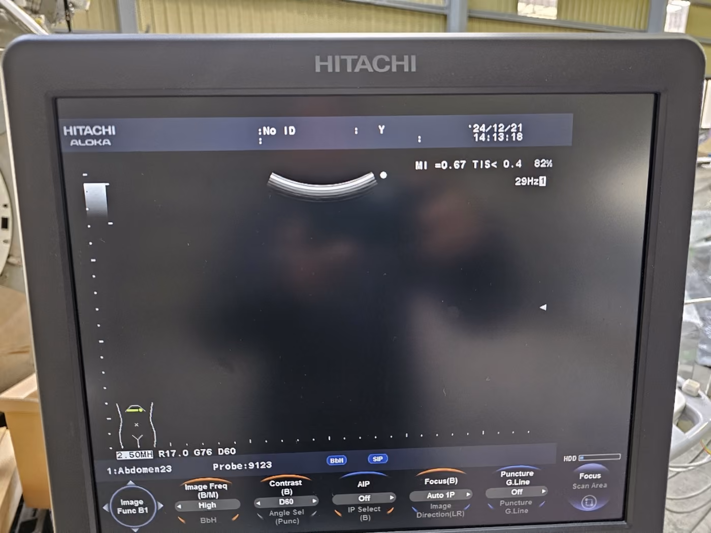 2011 Hitachi Aloka F37, photo 7
