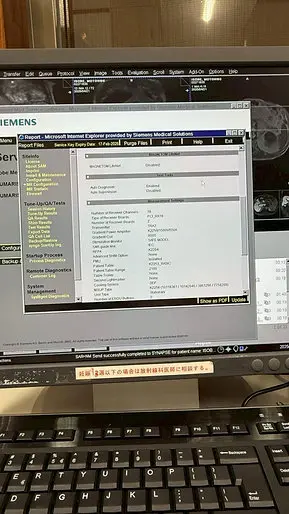 2008 Siemens Avanto1.5T, photo 3