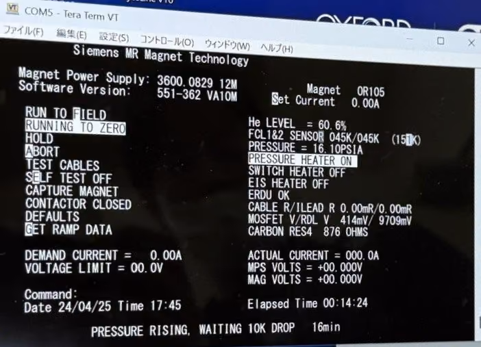 2008 Siemens Avanto1.5T, photo 11