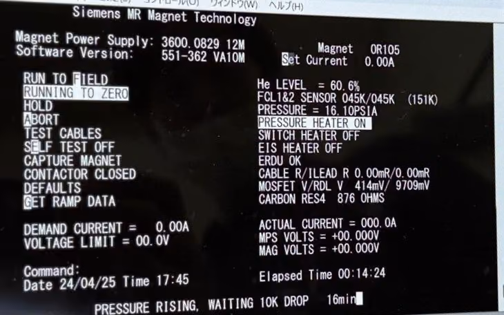 2008 Siemens Avanto1.5T, photo 12