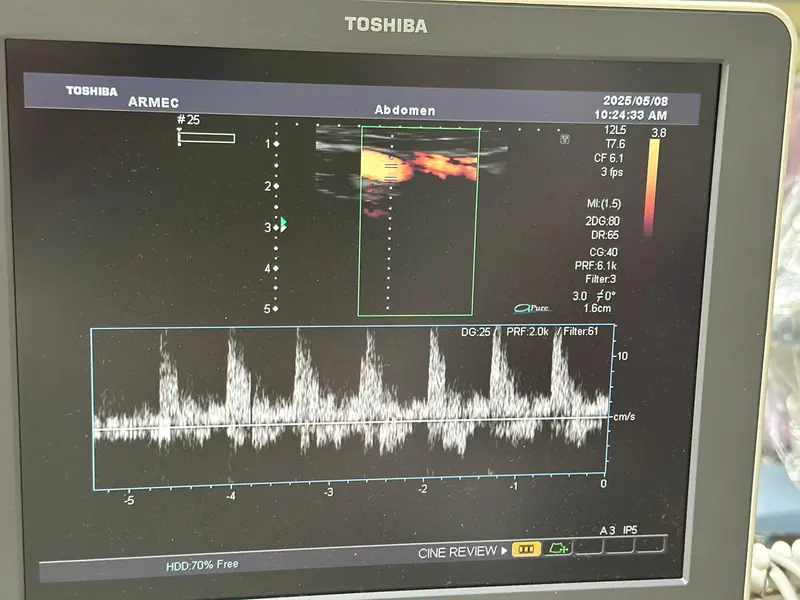 2010 Toshiba Xario, photo 3