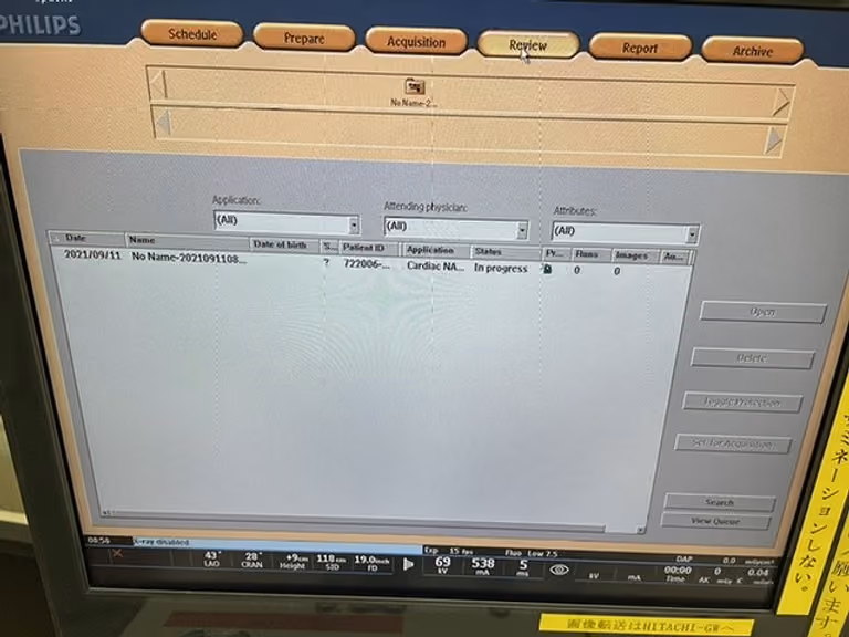 2009 Philips Allura FD20, photo 5