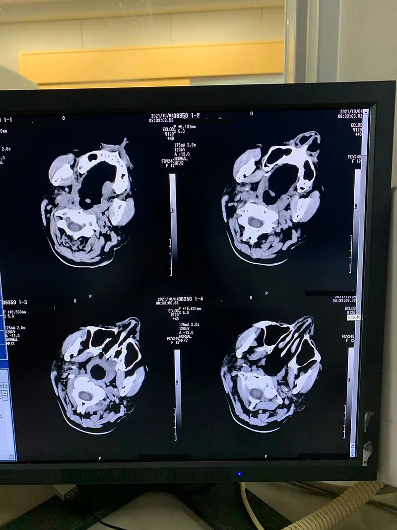 2019 Hitachi Eclos 16 Slice, photo 2